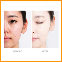 //jororwxhjpmlli5p.ldycdn.com/cloud/prBprKjllrSRqlqipiinkq/Skin-Care10.jpg